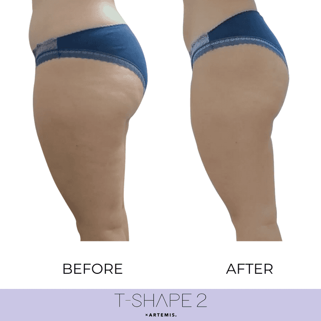 T-Shape 2 Total Body Transformation