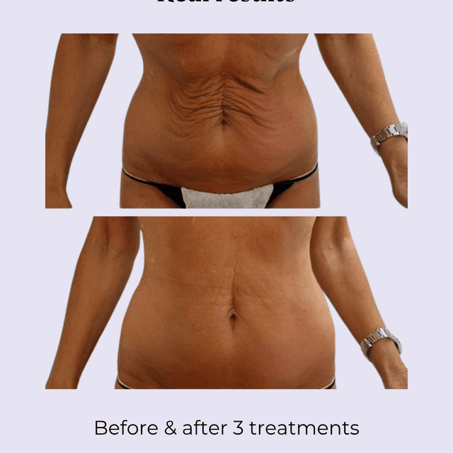 Elite Sculpt Membership